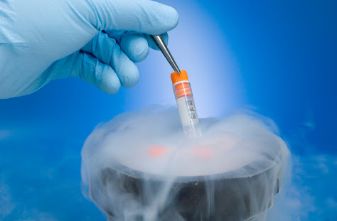 Cryopreservation of samples